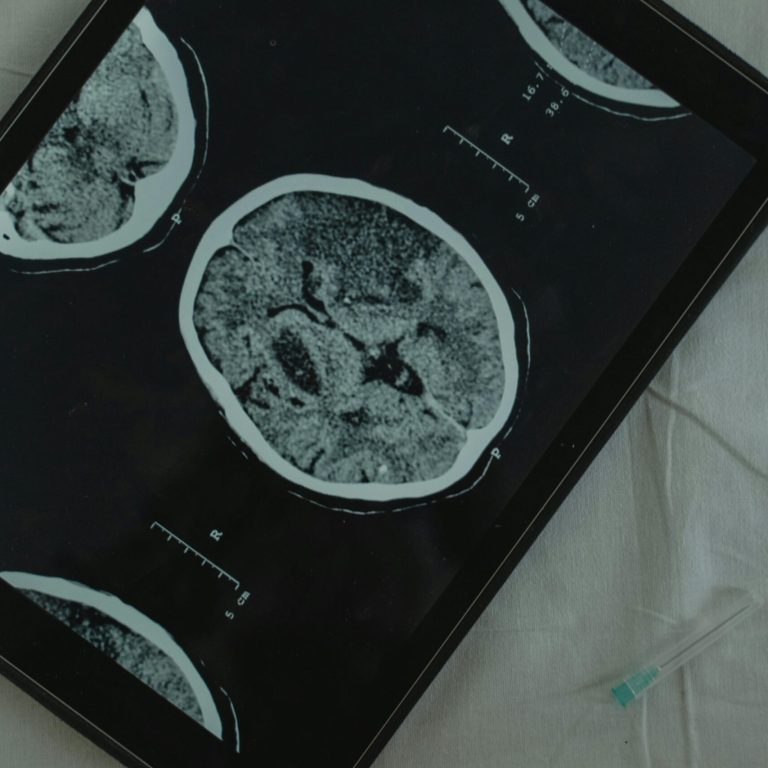 harlow gardens palm springs residential rehabilitation center